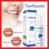 LANBENA Teeth Whitening Mousse 1